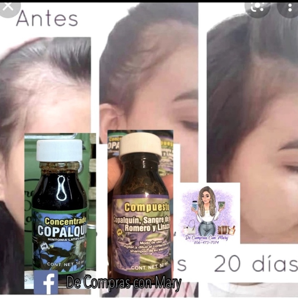 Hair Loss Regrowth Treatment 100%
made from herbs!!